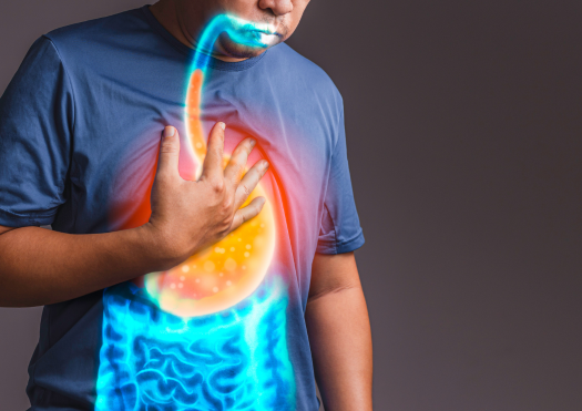 GERD Treatment Thumbnail